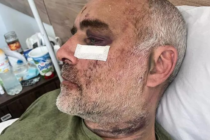 Der georgische Aktivist Davit Katsarava wurde im Mai 2024 von der Polizei schwer misshandelt. © privat